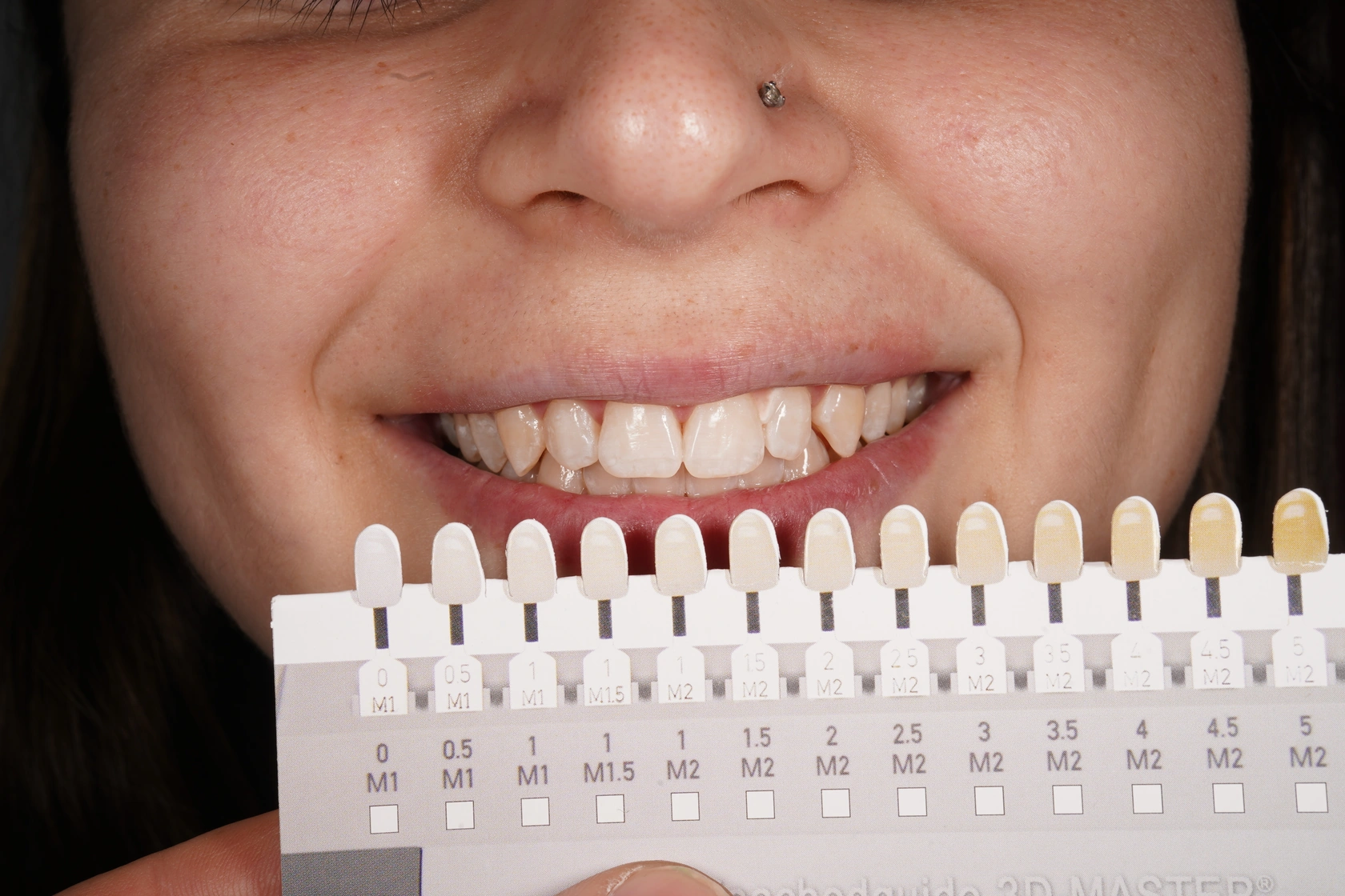 Guía de tonos dentales junto a la sonrisa para comparar colores